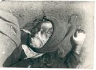 Photograph captioned Close up, showing the injuries, inflicted by a rifle butt, on the face of a deceased female internee of Belsen Concentration Camp, taken in Germany, April 1945