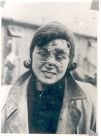 Photograph of an unidentified female internee at Belsen concentration camp, Germany, n.d., [April - May 1945]