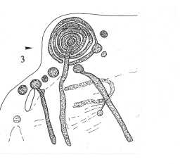 Illustration of a cup-and-ring-marked boulder, Scale Knoll, Barningham Moor 1980-1997 Illustration of a cup-and-ring-marked boulder, Scale Knoll, Barningham Moor 1980-1997