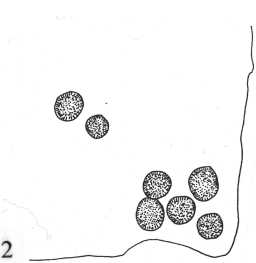 Illustration of a cup-marked stone, Grey Stones, Barningham Moor 1980-1997