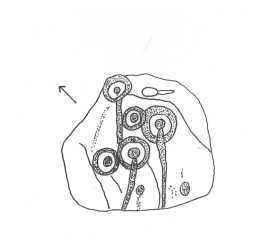 Illustration of a multiple cup-and-ring-marked boulder, Scale Knoll, Barningham Moor 1980-1997